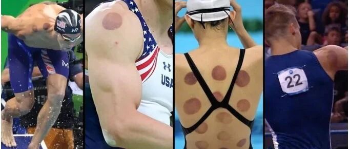 【健康关注】“神秘印记”再现东京奥运会！