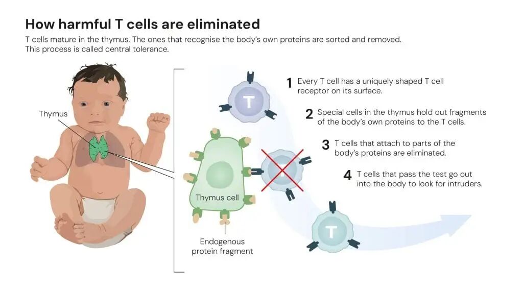 插图：有害 T 细胞如何被消除