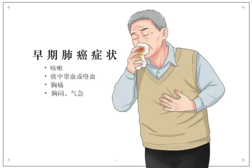 肺部结节 肺部结节