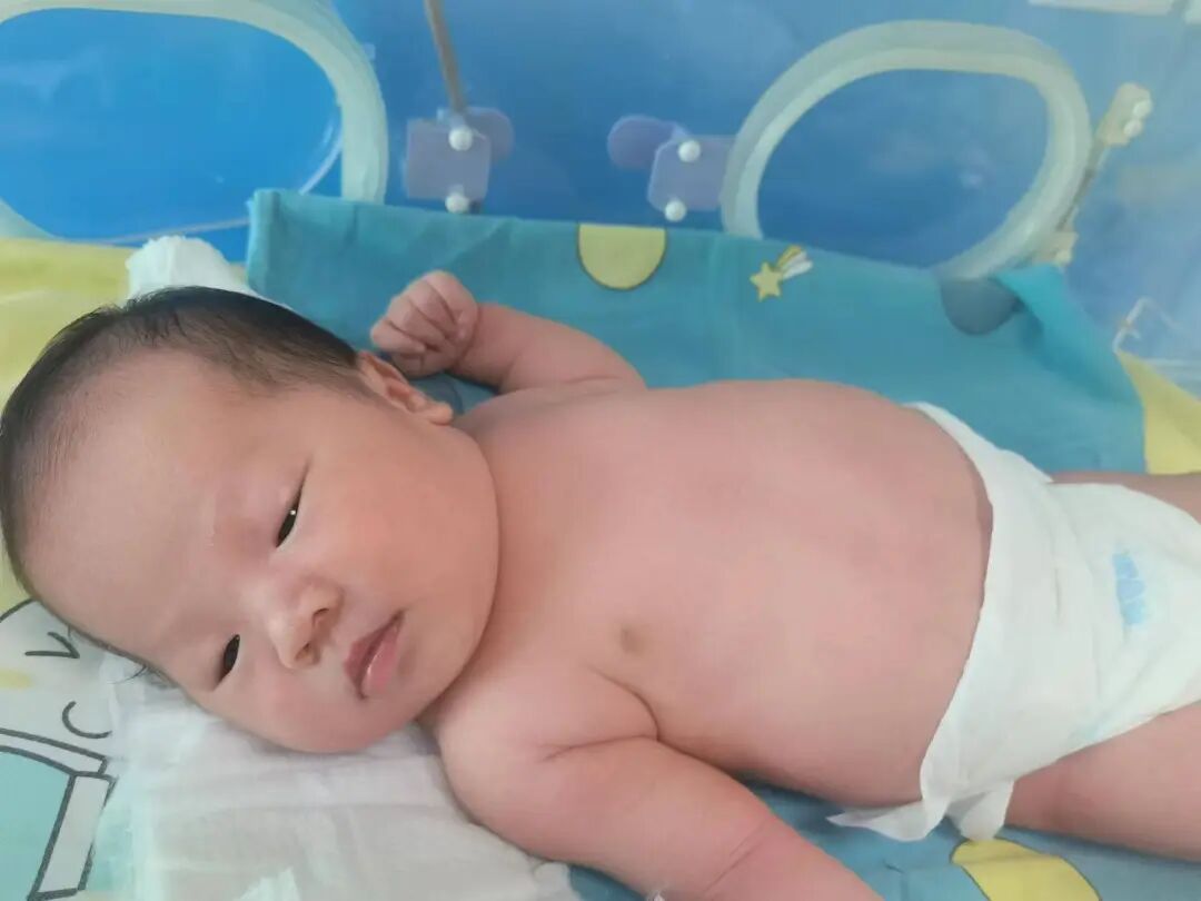 为什么要用光疗纸尿裤新生儿黄疸不用住院！卧龙区妇幼保健院日间光疗，宝宝白天做光疗，晚上回怀抱_https://www.jmylbn.com_新闻资讯_第4张