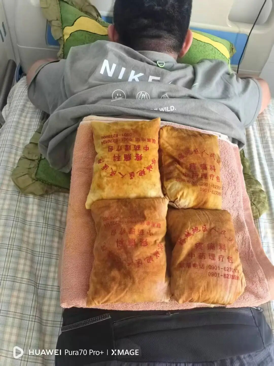 疼痛科怎么理疗改善护理服务行动丨疼痛科、肿瘤科：从护理评估到特色理疗，全方位提升患者住院体验_https://www.jmylbn.com_新闻资讯_第9张