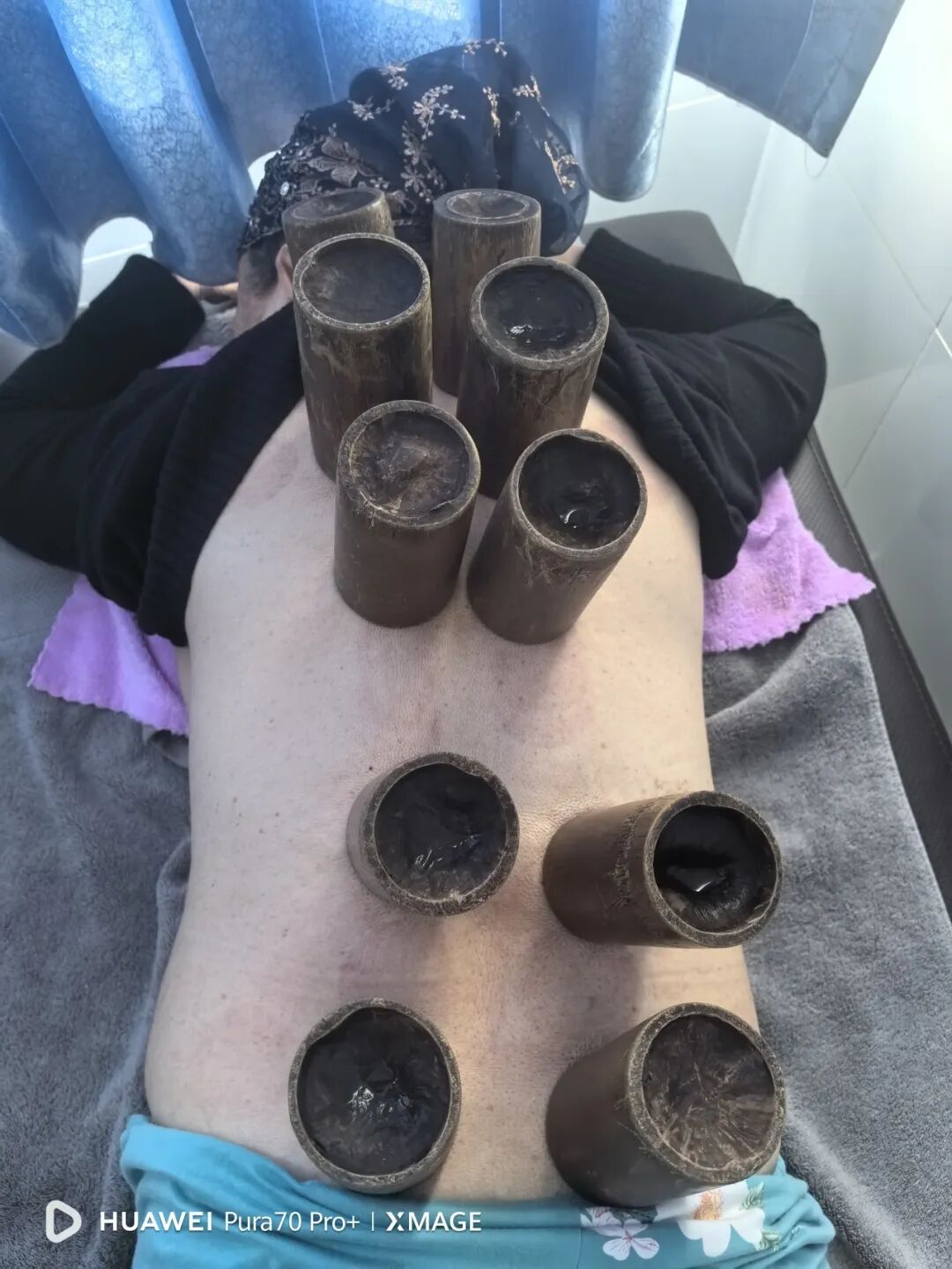 疼痛科怎么理疗改善护理服务行动丨疼痛科、肿瘤科：从护理评估到特色理疗，全方位提升患者住院体验_https://www.jmylbn.com_新闻资讯_第11张