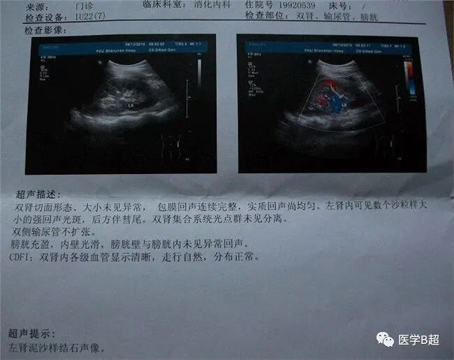 b超md是什么意思B超标准报告单模板_https://www.jmylbn.com_新闻资讯_第2张