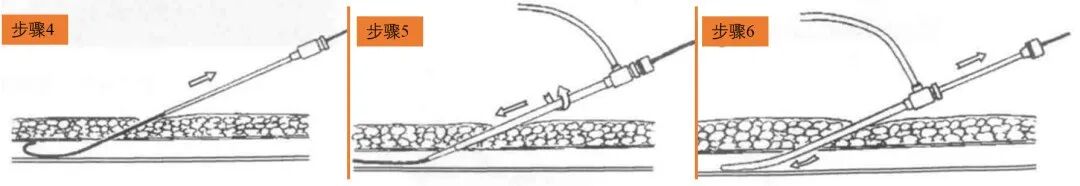 导管鞘怎么念导管鞘的介绍_https://www.jmylbn.com_新闻资讯_第7张