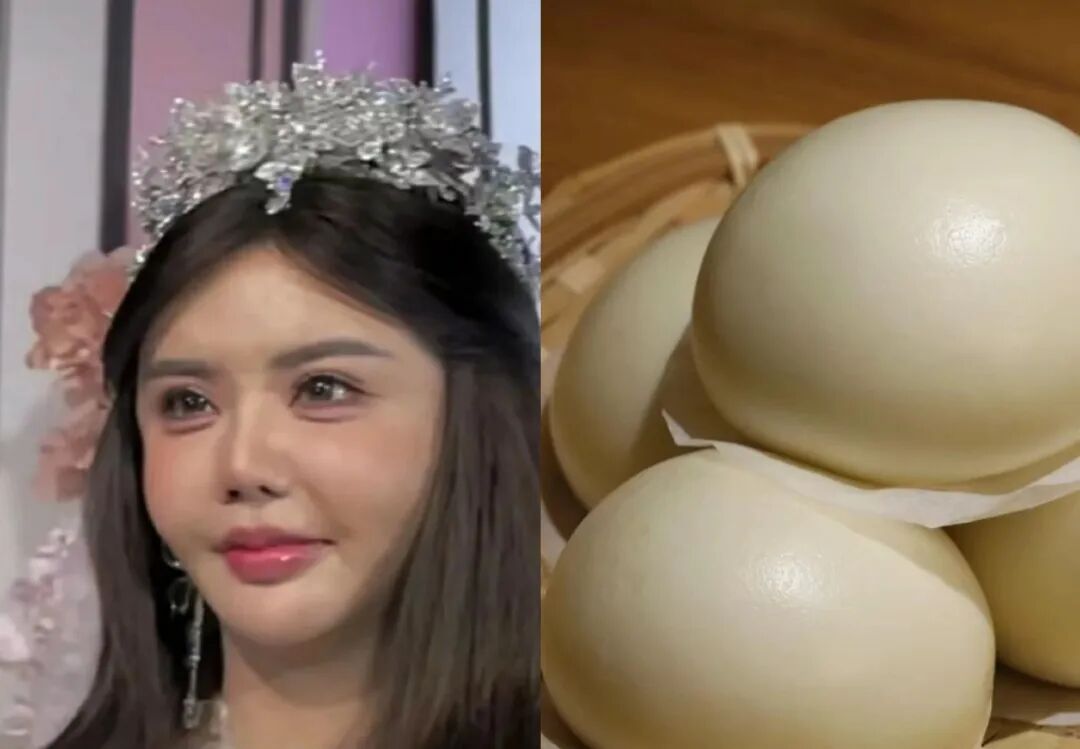 女子过度医美面部馒化酷似面具人