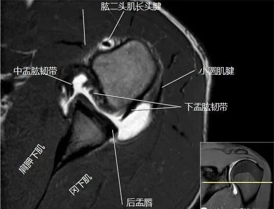 肩关节磁共振（MRI）经典解剖