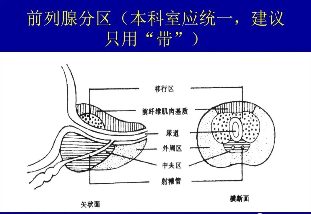 前列腺解剖及mri表现
