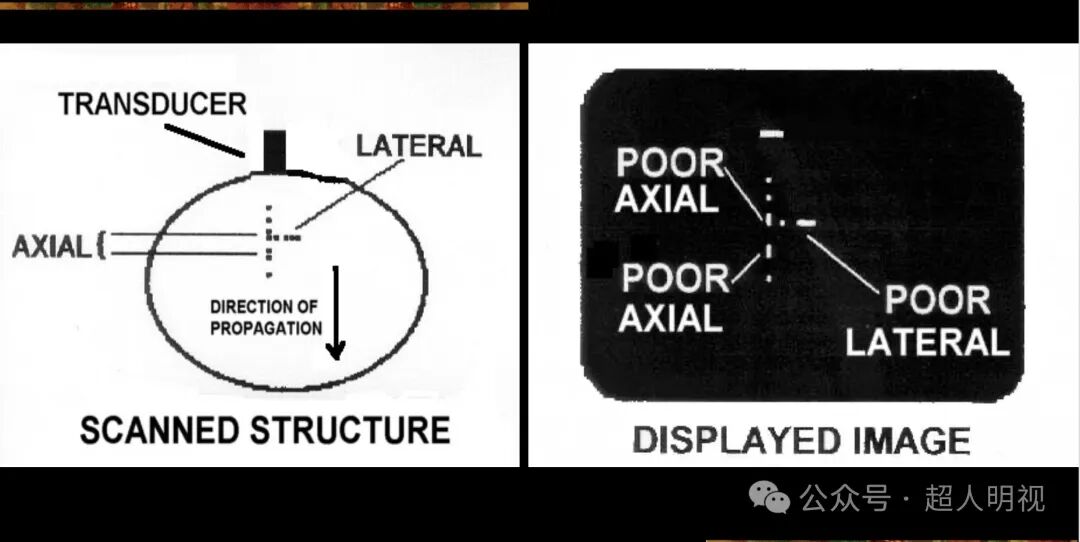 彩超伪像是什么超声伪像_https://www.jmylbn.com_新闻资讯_第1张