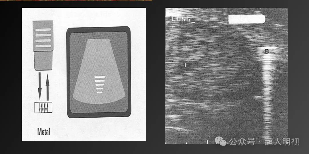 彩超伪像是什么超声伪像_https://www.jmylbn.com_新闻资讯_第7张