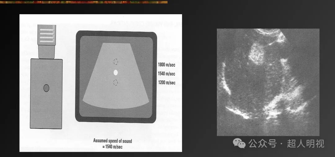 彩超伪像是什么超声伪像_https://www.jmylbn.com_新闻资讯_第9张