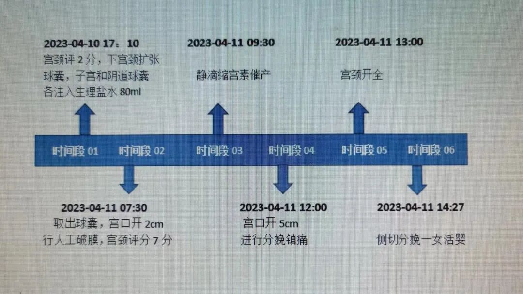 子宫颈扩张球囊是什么提高正常分娩的好方法——宫颈扩张球囊_https://www.jmylbn.com_新闻资讯_第3张