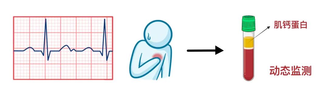 急性冠状动脉综合征，临床必备！