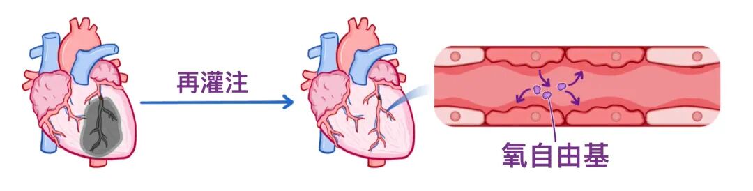 急性冠状动脉综合征，临床必备！