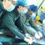 中国医大一院血管外科/甲状腺外科张健教授完成首例主动脉弓部动脉瘤支架原位开窗重建弓上三分支的全腔内微创治疗