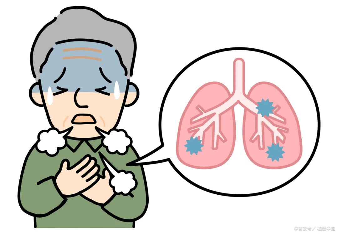 什么是血氧仪脉搏血氧仪：你会用吗_https://www.jmylbn.com_新闻资讯_第12张