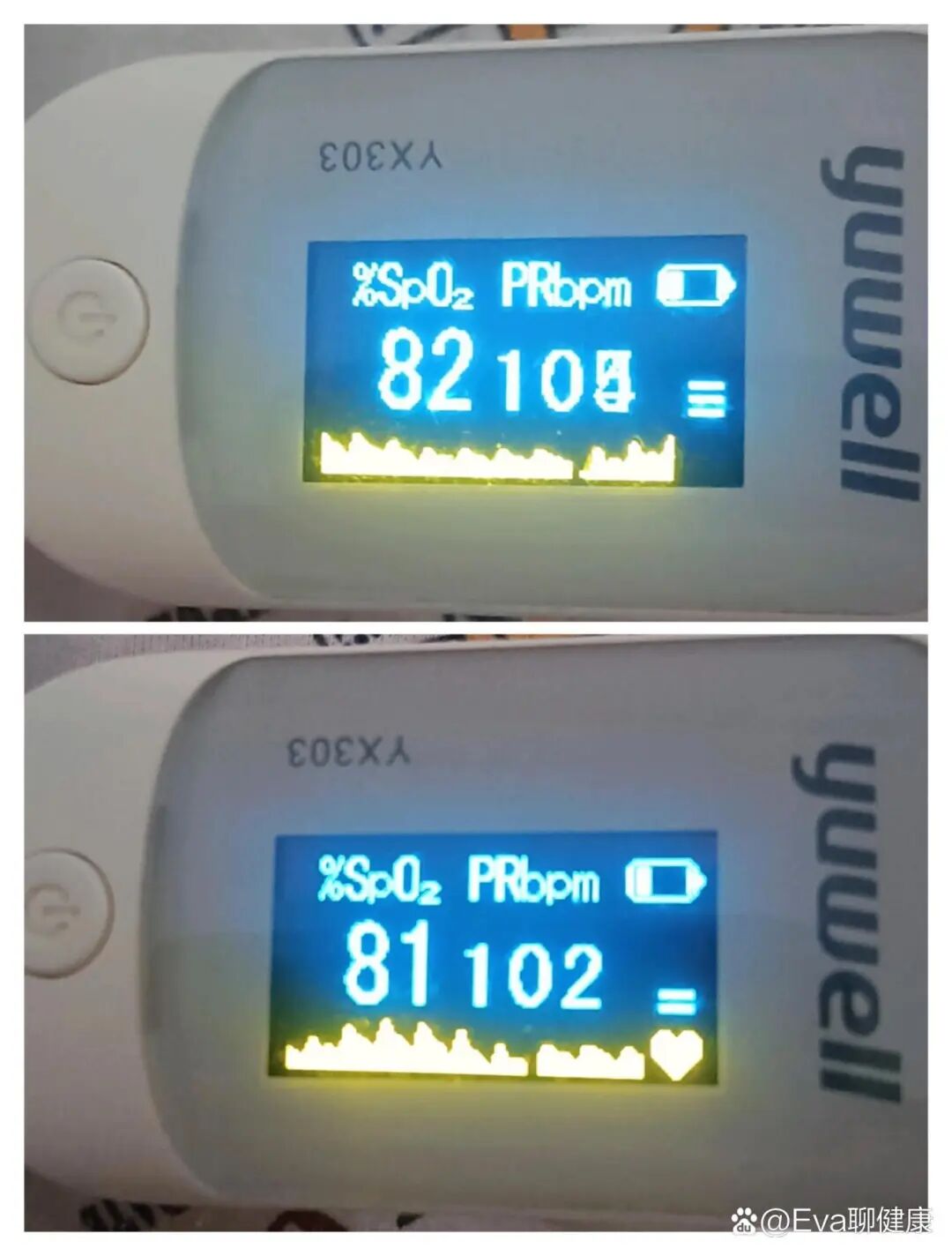 什么是血氧仪脉搏血氧仪：你会用吗_https://www.jmylbn.com_新闻资讯_第15张