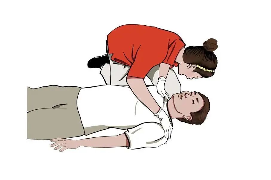 cpr按压板怎么放置【健康之窗】急救科普 ｜ 心肺复苏（CPR）全攻略_https://www.jmylbn.com_新闻资讯_第21张