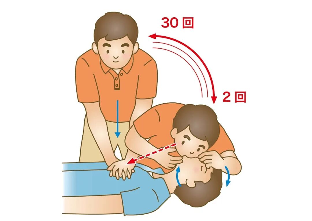 cpr按压板怎么放置【健康之窗】急救科普 ｜ 心肺复苏（CPR）全攻略_https://www.jmylbn.com_新闻资讯_第43张