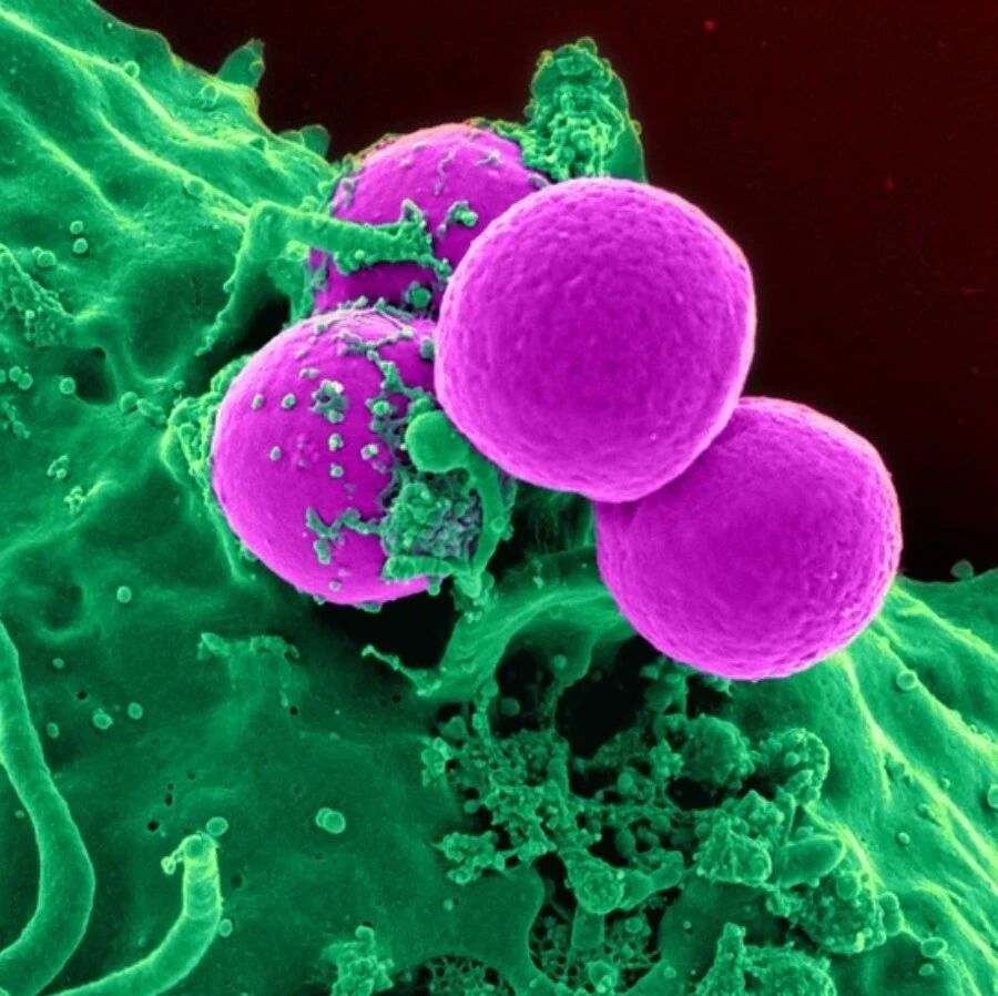 涨知识！衰退的免疫系统是癌症发生的主因，回输免疫细胞是解决之道