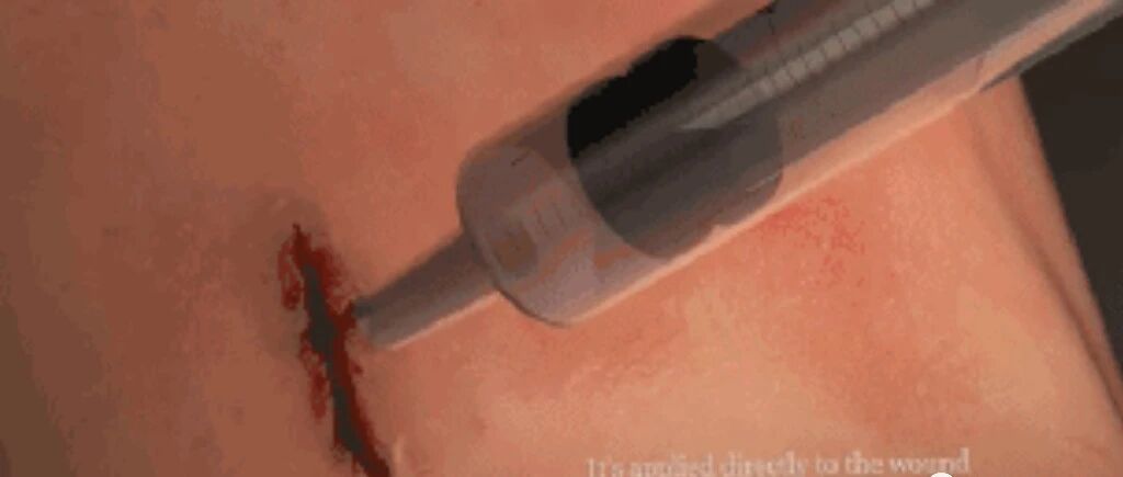 干细胞技术｜医学发展的方向,是让身体自我修复