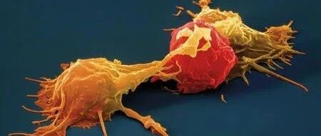 “攻击”、“瓦解”、“消灭”！免疫细胞杀癌三部曲，精彩绝伦！