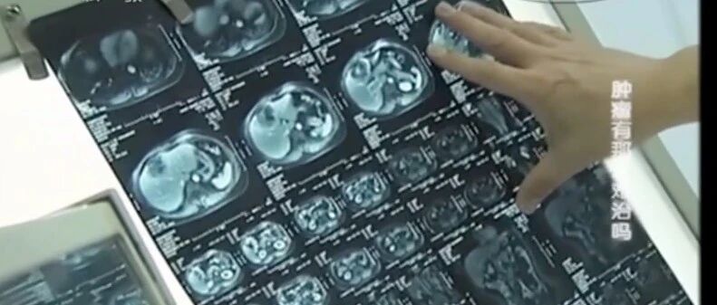 90%的癌症患者死亡原因找到了！免疫疗法或是降低转移风险的“根本措施”