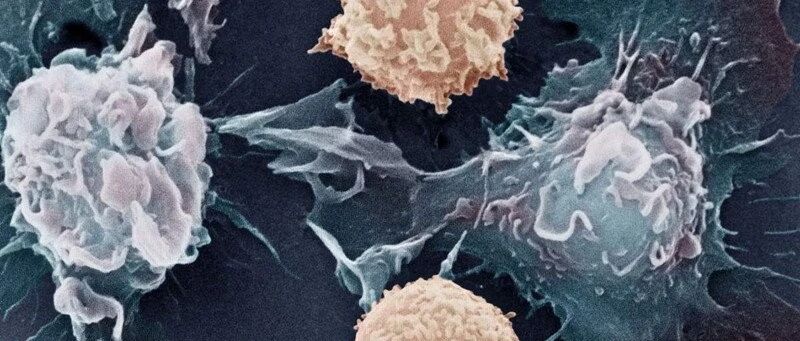 CIK单次治疗9.5万,黑马CAR-CIK横空出世,有望决胜120万一针的CAR-T