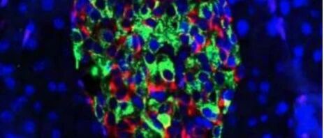 Cell Metabolism：基因编辑β细胞，有望维持糖尿病不复发长达“40-50”年