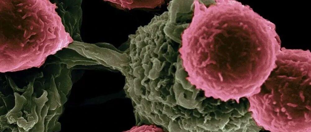 “解放天性”的NK细胞，癌细胞的“终结者”