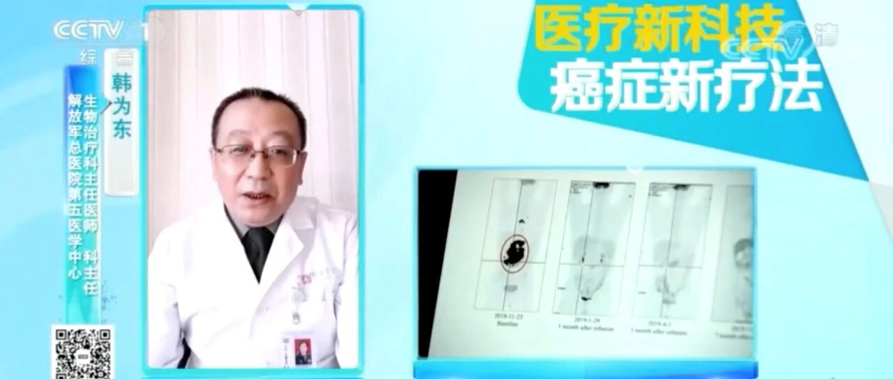 CCTV：改造的免疫细胞 揭开肿瘤的伪装