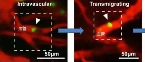 干细胞治疗前必读｜回输进体内的干细胞 都去哪了？