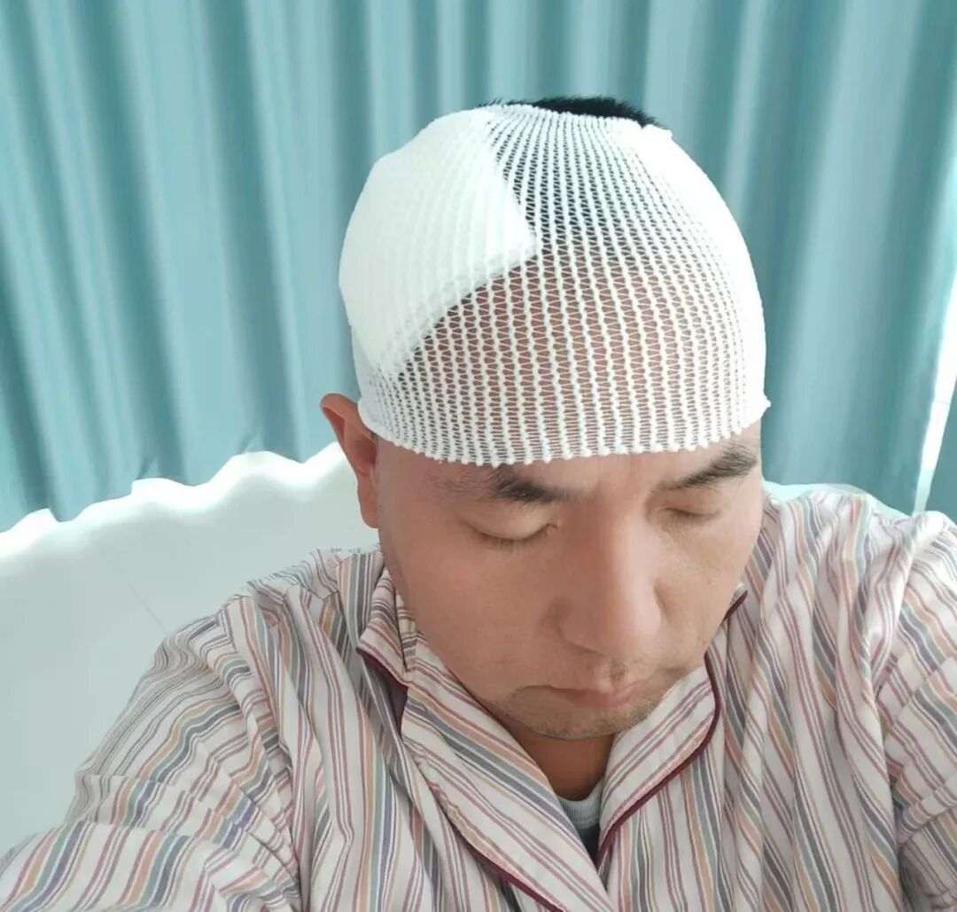 英勇抗衡!顺义一男子遭盗贼用斧头砍伤头部!