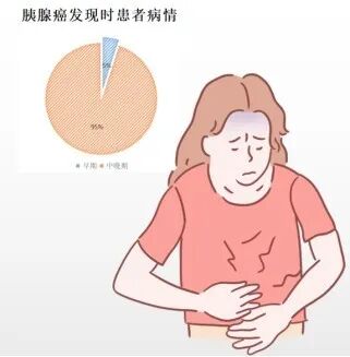 胰腺癌晚期症状，早发现早治疗！