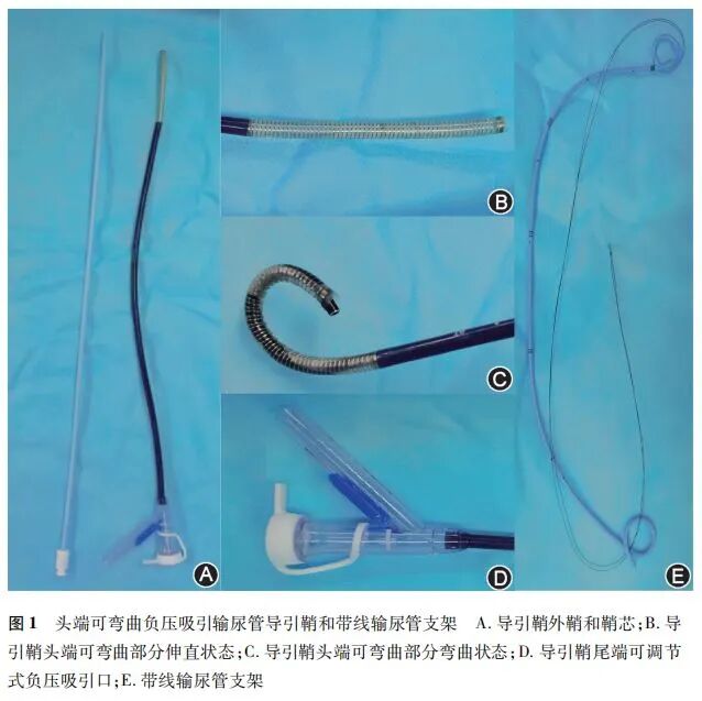 输尿管鞘是什么【临床研究】头端可弯负压吸引鞘辅助的输尿管软镜碎石术后无管化离院的可行性和安全性_https://www.jmylbn.com_新闻资讯_第5张