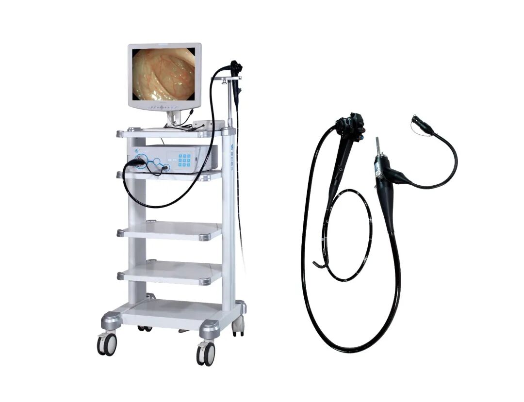 耳鼻喉内窥镜检查是检查什么什么是耳鼻喉内窥镜检查？如何配合完成内镜检查_https://www.jmylbn.com_新闻资讯_第3张