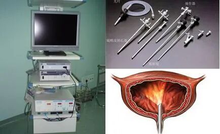 b膀胱镜为什么消毒泌尿外科医生的好帮手：膀胱镜检查_https://www.jmylbn.com_新闻资讯_第4张