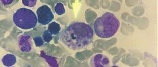 江苏37人感染新型病毒，专家：夏季易发生，警惕人传人！！