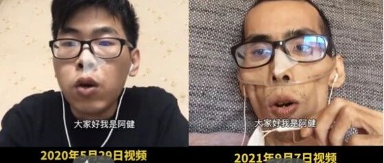 抗癌博主去世，一年时间从帅哥变成老人！这10个重要提醒一定要看完！
