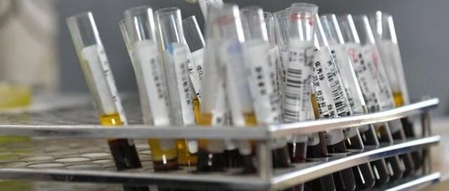 “滴血验癌”公司创始人被定罪！现在知道这些健康骗局还不晚！