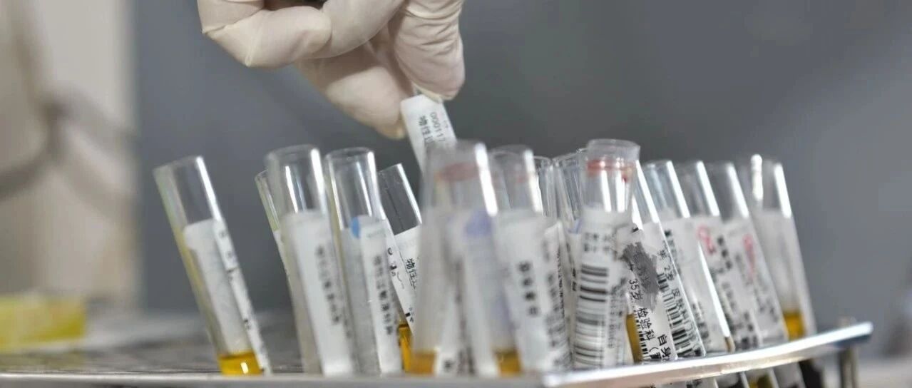 高胆固醇血症十年增3倍！4个原因值得深思！