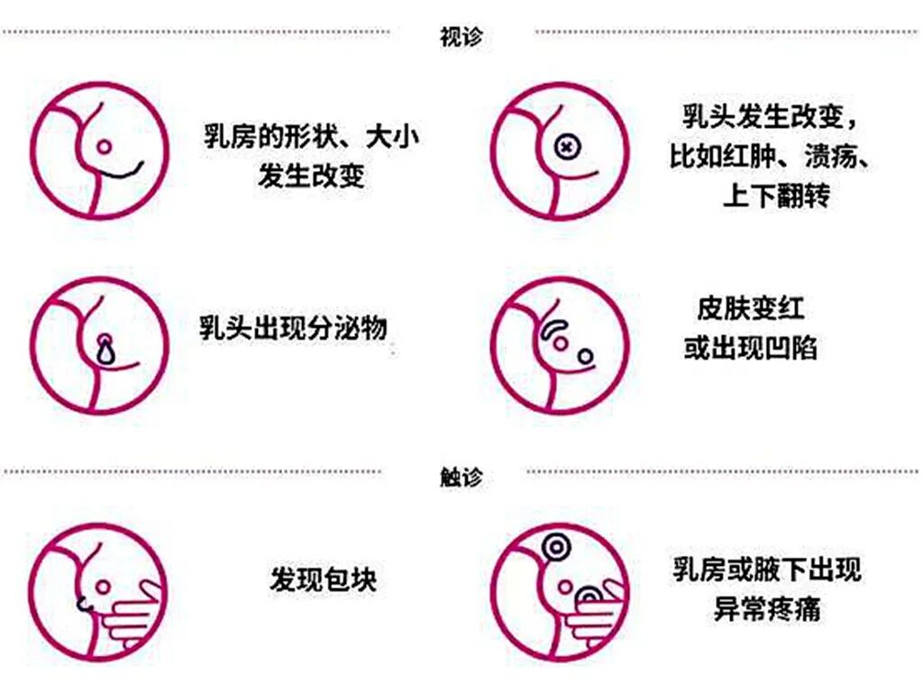 乳腺dr能检查什么乳腺隐疾的小病灶无所遁形——任泽区人民医院医疗新武器→富士乳腺断层DR（放射科）_https://www.jmylbn.com_新闻资讯_第7张