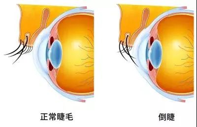 眼睛竟能反映出這麼多問題？別錯過它發出的危險「信號」，快收藏↓ 健康 第7張