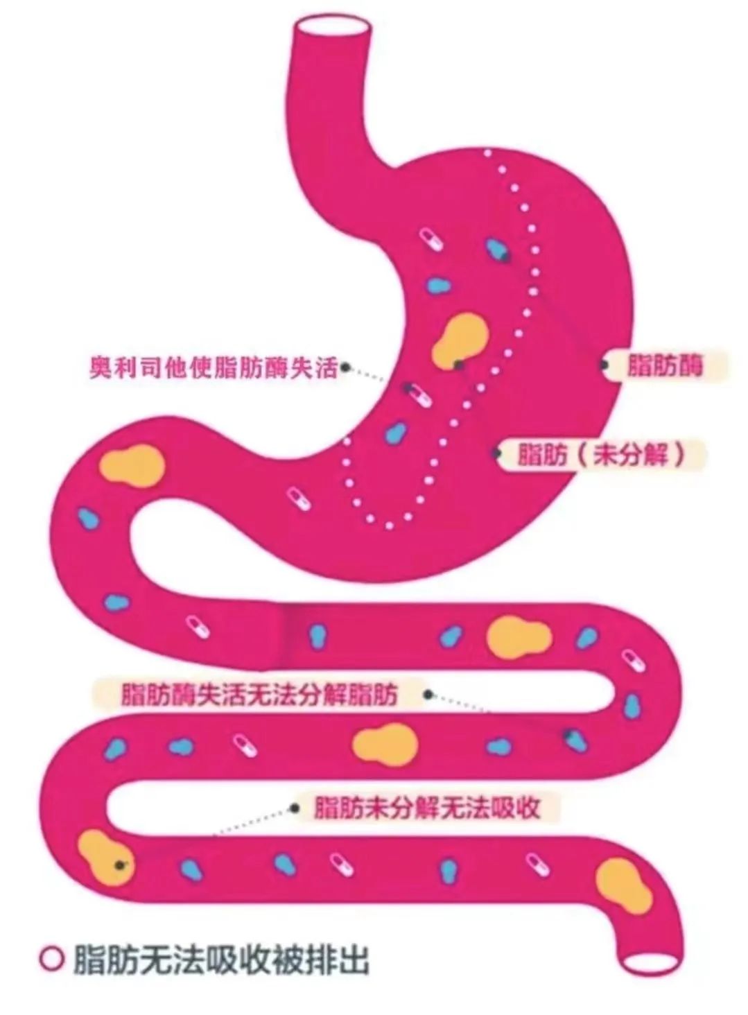 药物减肥_减肥药物前十名_內分泌减肥药物