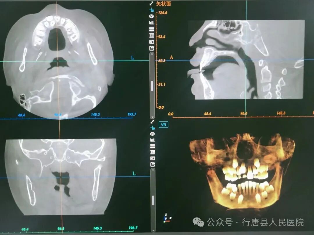 口腔ct怎么拍摄【高端设备】口腔医生的好帮手——口腔CT摄影机_https://www.jmylbn.com_新闻资讯_第8张