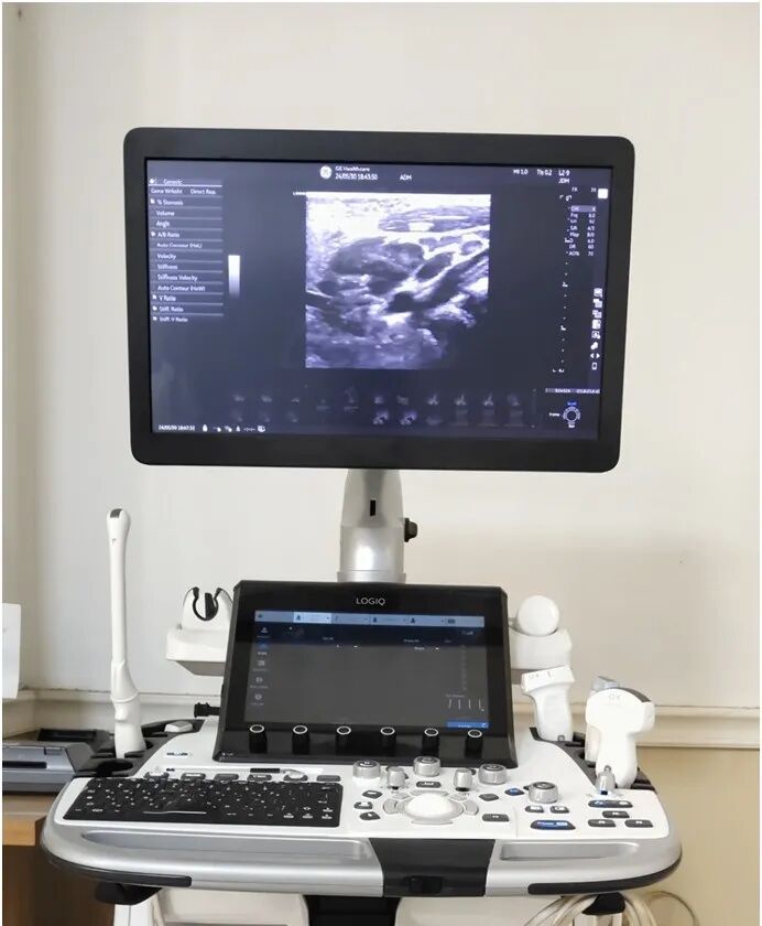 logiq e怎么读【高端设备】从多个维度观察血管、组织的血流灌注、像素合成在瞬间完成——美国GE超声高端旗舰机LOGIQ™ E11_https://www.jmylbn.com_新闻资讯_第1张