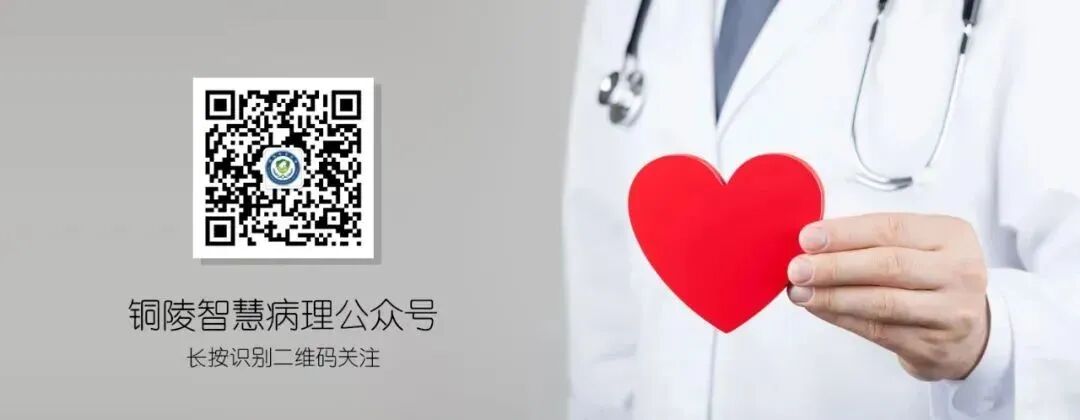 fh染色是什么意思讲座｜ FH缺失型子宫平滑肌瘤_https://www.jmylbn.com_新闻资讯_第1张