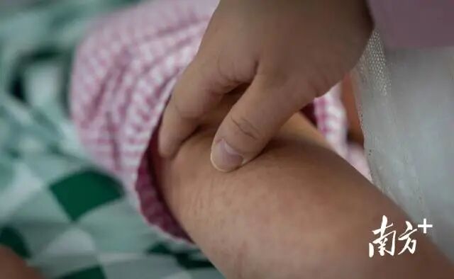 佛山乐从医院内，医护人员查看基孔肯雅热病人症状。