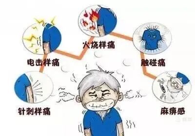 双极射频是什么山一大二附院疼痛科：三叉神经半月节双极脉冲射频调节术解除疼痛困扰_https://www.jmylbn.com_新闻资讯_第4张