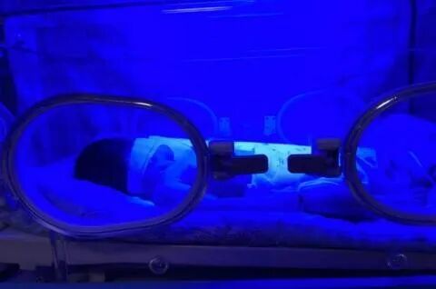 为什么要用光疗纸尿裤陵城区人民医院儿保中心开展日间蓝光治疗 不用住院就可以给黄疸宝宝照蓝光了！_https://www.jmylbn.com_新闻资讯_第5张