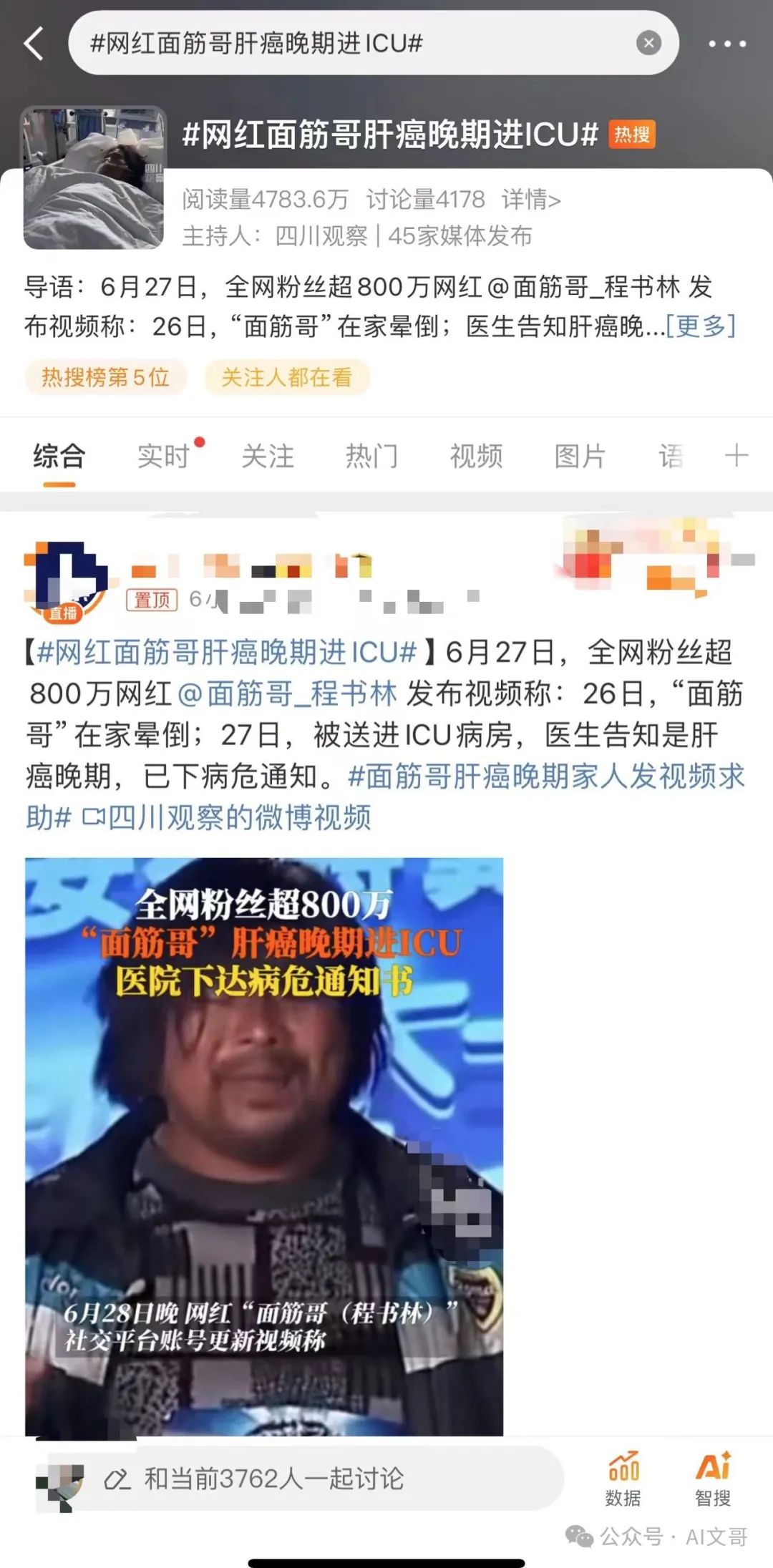 面筋哥肝癌进ICU